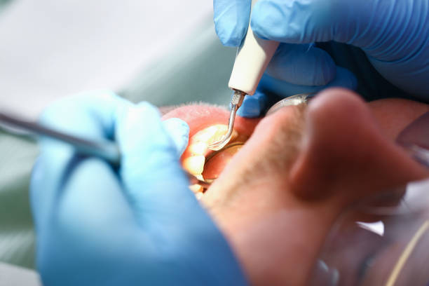 Best Tooth Infection Emergency Dentist  in Fullerton, PA