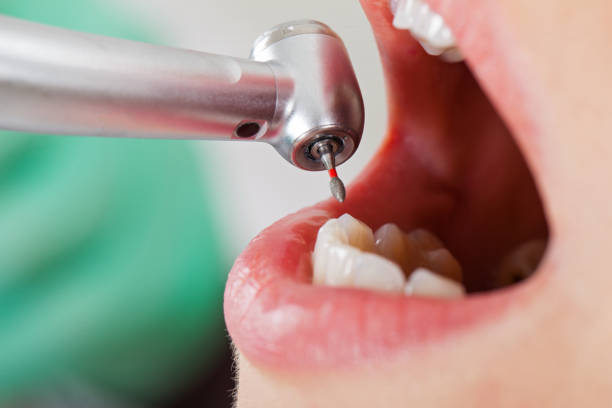 Best Emergency Dental Filling Replacement  in Fullerton, PA